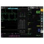 Monitor gima bm3 pro - spo2+ecg+nibp+temp+resp