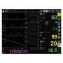 Monitor gima bm3 pro - spo2+ecg+nibp+temp+resp
