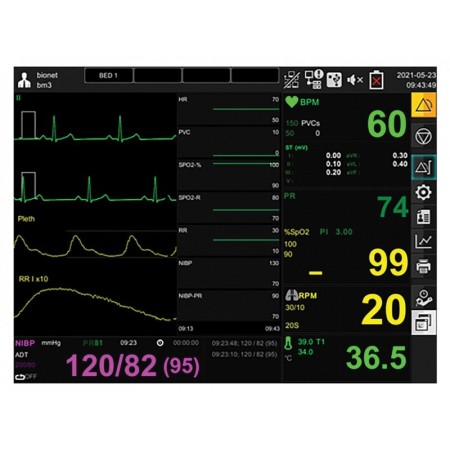 Monitor gima bm3 pro - spo2+ecg+nibp+temp+resp
