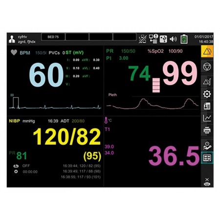 Monitor gima bm3 pro - spo2+ecg+nibp+temp+resp