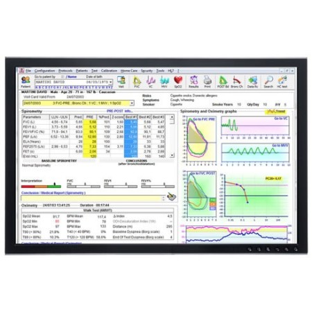 Spirometro mir spirolab con stampante e software mir spiro