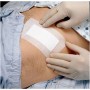 3m medipore + pad medicazione sterile in tnt con tampone, 3569e - 10x15cm - 25pz.