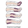 Pressoterapia pressomassaggio mesis plus+ con 2 gambali + kit slim body + bracciale