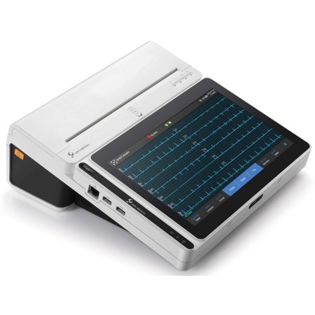 Tablet neoecg t180 ecg a 12 derivazioni con interpretazione di glasgow e stampante