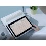 Tablet neoecg t180 ecg a 12 derivazioni con interpretazione di glasgow e stampante