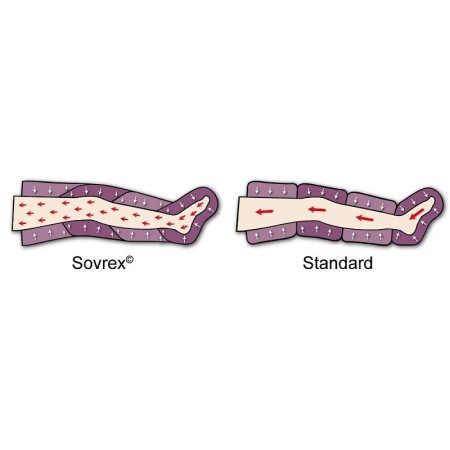 Bracciale sovrex (senza connettore) per pressomassage