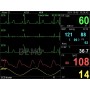Monitor multiparametrico pc-3000