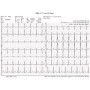 Elettrocardiografo wireless pc-ecg euro ecg bt12