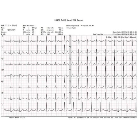 Elettrocardiografo wireless pc-ecg euro ecg bt12