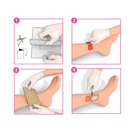 Inadine (pvp-i) medicazione non aderente p01481, 5 cm x 5 cm - 25 pz.