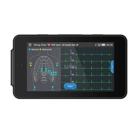 Elettrocardiografo palmare tascabile pcecg-500 con interpretazione glasgow