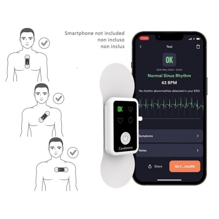 Ecg cardionica a 1 canale con afib e bluetooth