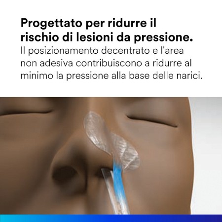 Sistema di fissaggio per sondino nasogastrico 3m 1501ng misura m - 50 pz.