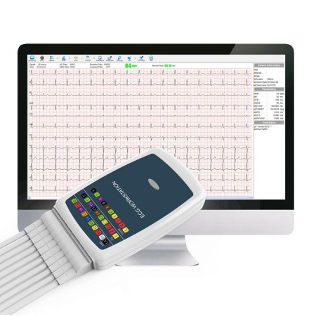 Stazione di lavoro ecg wireless contec 8000 - 12 canali