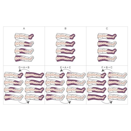 Pressoterapia pressomedical 6.0 complete con 2 gambali + kit slim body + 2 bracciali