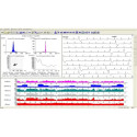 Holter ecg 24 h con software