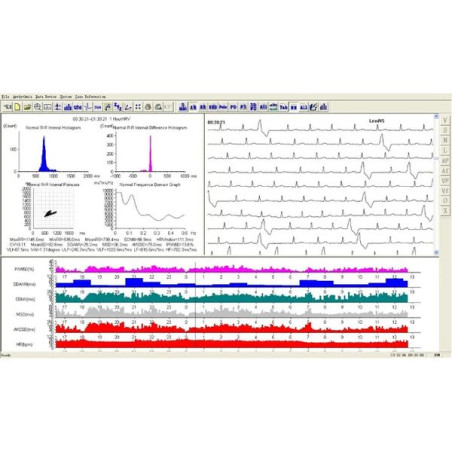 Holter ecg 24 h con software